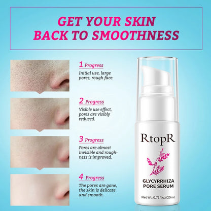 Repair Shrinking Pores Whitening Remove Blackheads